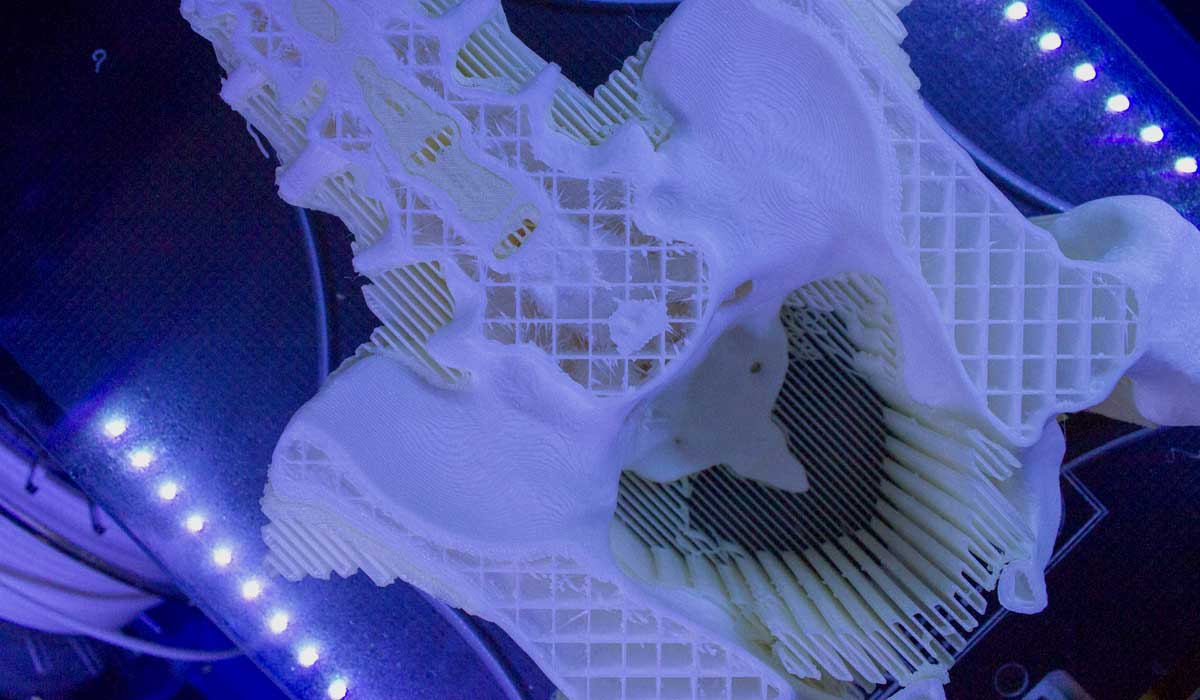 BCN3D_3D_Printing_Industry_Use_Case_Hospital_Universitario_Puerta_del_Mar